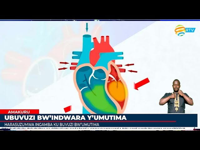 ⁣Ubuvuzi bw'indwara y'umutima buhagaze gute mu gihugu?