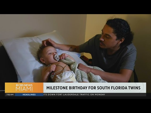 South Florida twins with rare congenital heart defect celebrate their first birthday