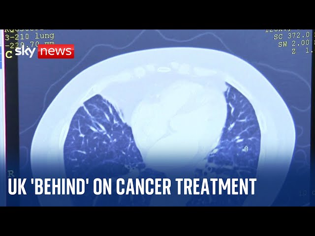 UK cancer patients suffering as nation behind in treatments, research suggests