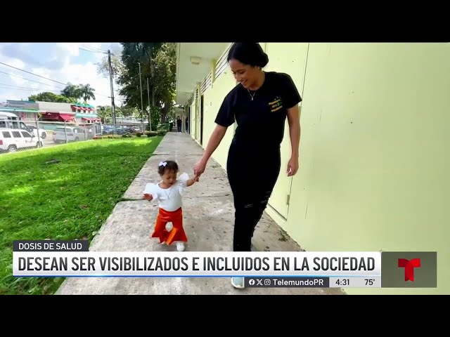 La importancia de las terapias para niños con Síndrome Down