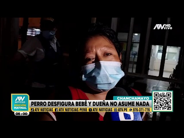 Chanchamayo: Perro desfigura a bebé y dueña no asume nada