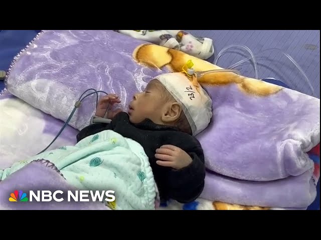 Gaza hospital overwhelmed by hunger and malnutrition among neonates