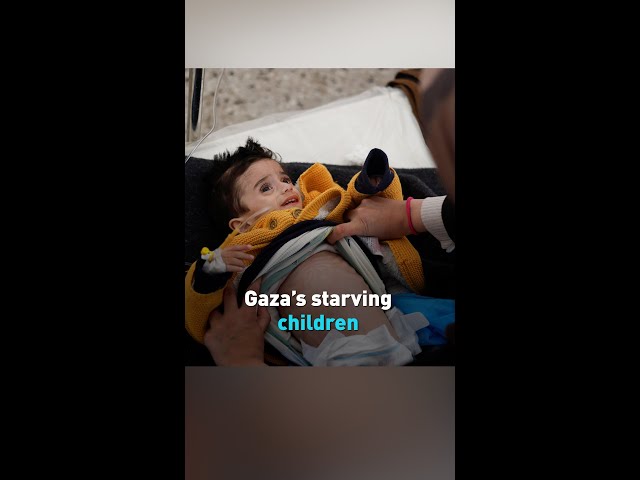 Gaza’s starving children