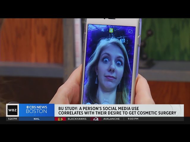 Social media use correlates with person's desire to get plastic surgery, Boston University stud