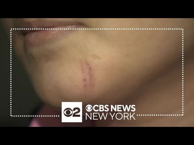 17-year-old talks about defending pregnant sister from assault in NYC subway system