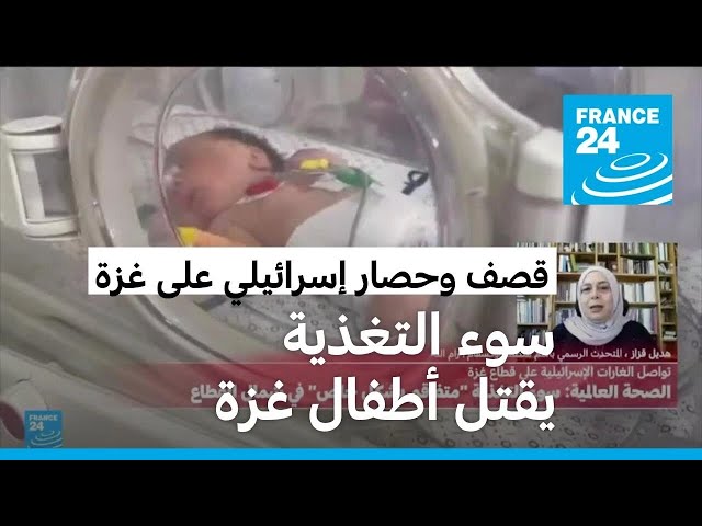 مع تفاقم أزمة الجوع في غزة.. شبح الموت بسوء التغذية يتربص بعشرات الأطفال