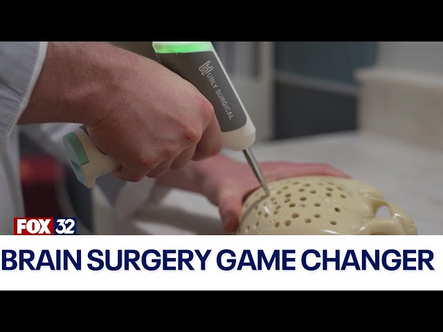 Chicago hospital introduces game-changing Hubly drill for brain surgery