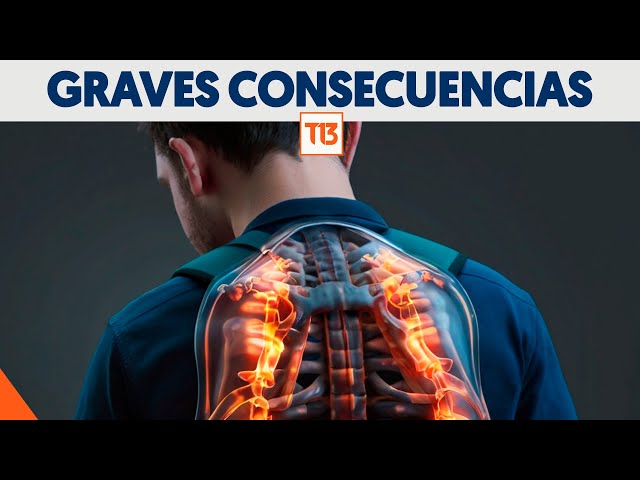 Estas usando mal tu mochila, te estás dañando gravemente la espalda y no lo sabías