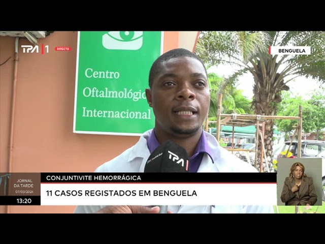 Conjuntivite Hemorrágica  - 11 casos registados em Benguela