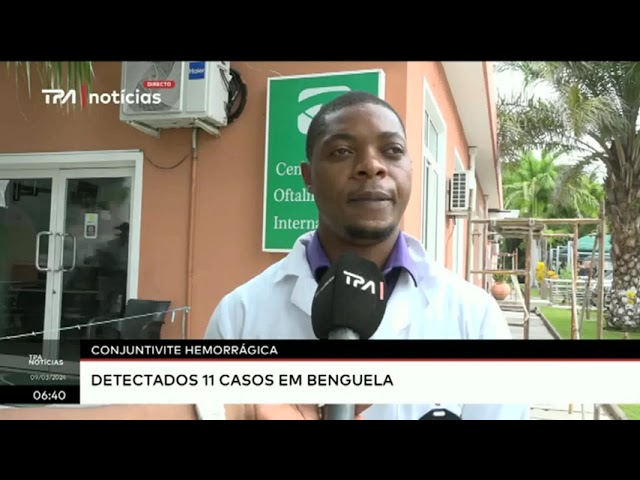 Conjuntivite hemorrágica - Detectados 11 casos em Benguela