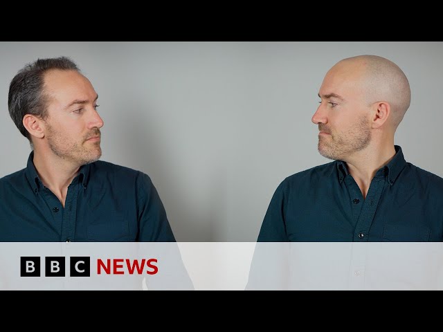 Why do we have hair on our heads? | BBC News