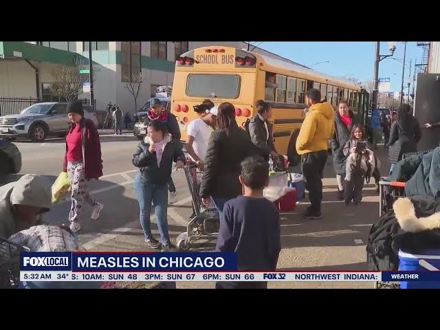 2nd migrant child diagnosed with measles attends CPS