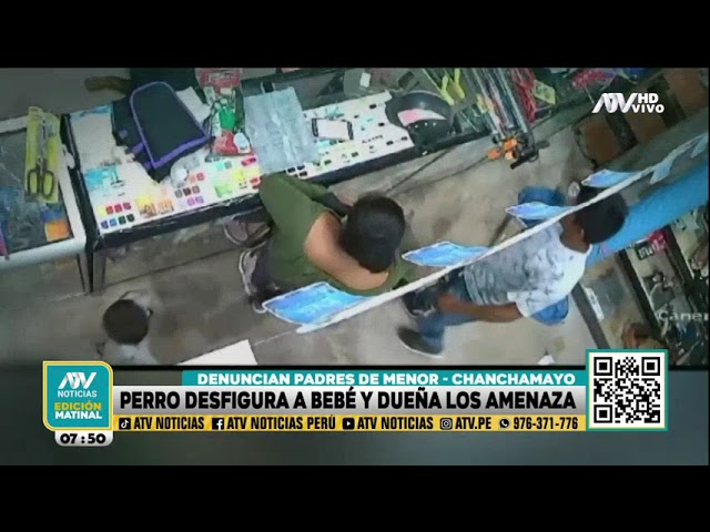 Chanchamayo: Perro desfigura a bebé y padres denuncian que reciben amenazas de la dueña