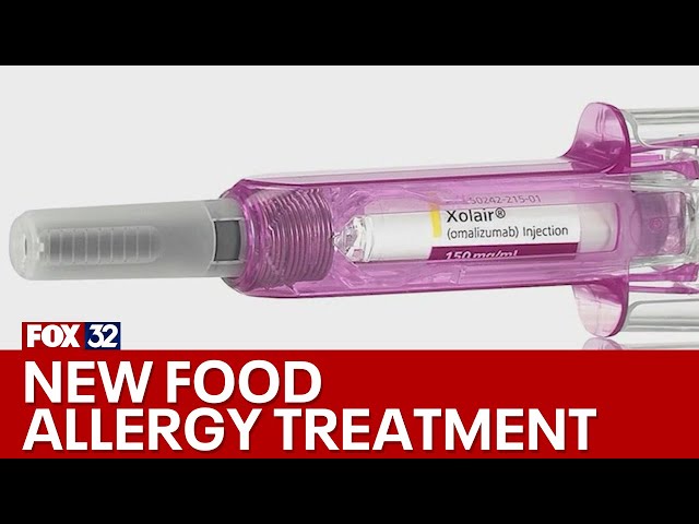 New treatment emerges for accidental food allergy exposures