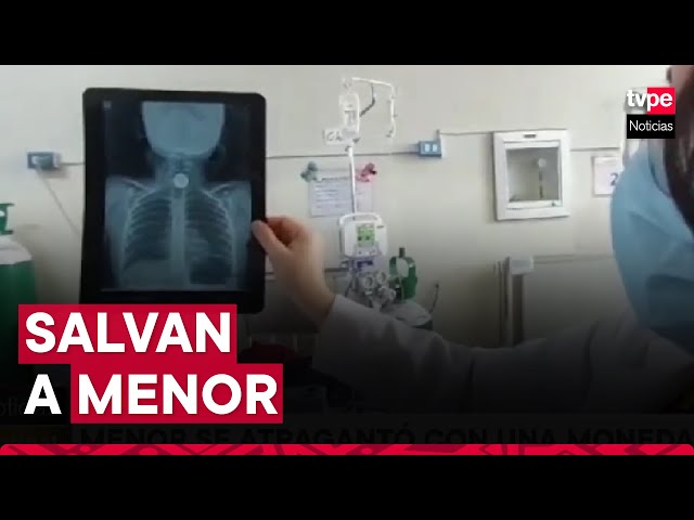 Cusco: menor se atragantó accidentalmente con una moneda