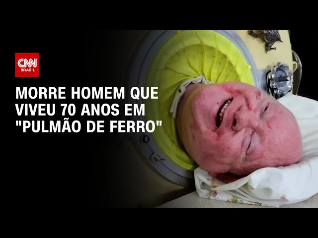 Morre homem que viveu 70 anos em "pulmão de ferro" | CNN PRIME TIME