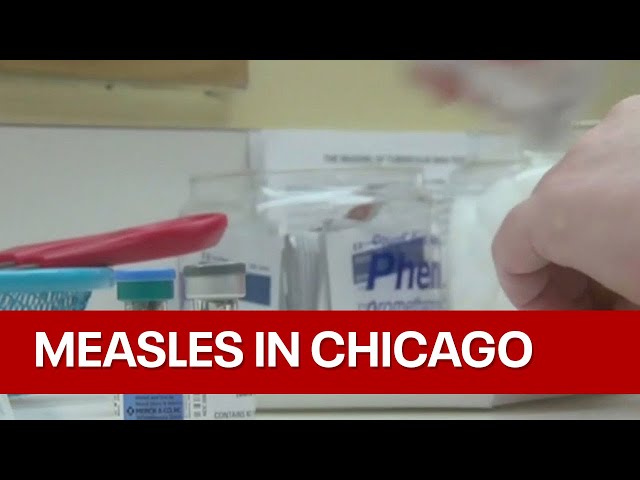 Measles in Chicago: Cases rise to 10 as health officials mobilize to contain outbreak