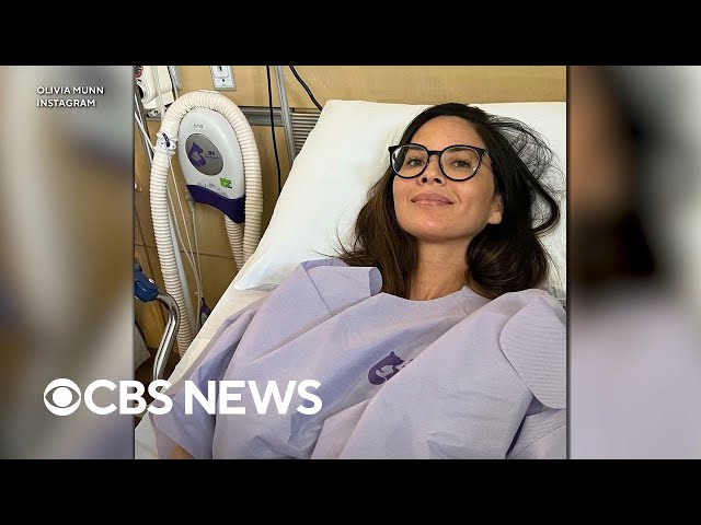 ⁣How risk assessment led to early breast cancer discovery in actor Olivia Munn