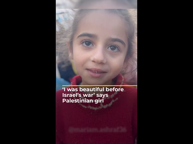 ‘The war made me ugly’ says Palestinian girl | AJ #shorts