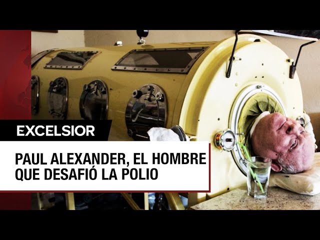 ¿Quién fue Paul Alexander, hombre que vivía en un pulmón de acero?