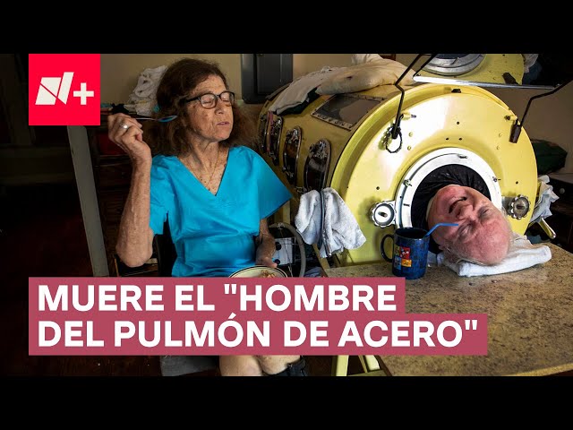 Paul Alexander, el “Hombre del Pulmón de Acero” muere a los 78 años - N+