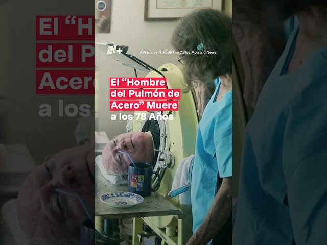 Paul Alexander, el “Hombre del Pulmón de Acero” muere a los 78 años - N+ #Shorts