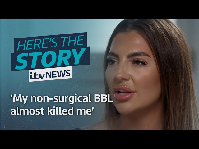 'My liquid BBL almost killed me' - Dramatic rise in horror non-surgical BBL stories | ITV 