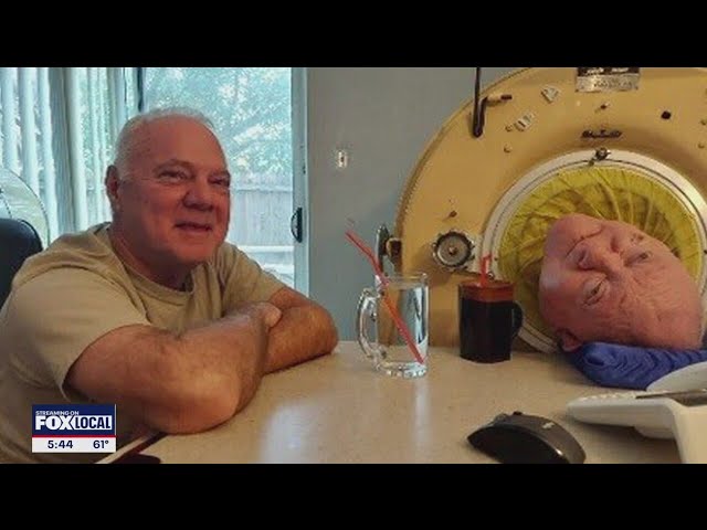 Brother of Dallas man who lived in iron lung shares his inspiring story