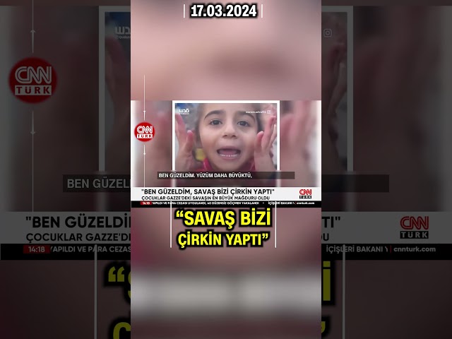 Gazzeli Küçük Kızın Sözleri Yürek Burktu: "Ben Güzeldim, Savaş Beni Çirkin Yaptı" #Shorts