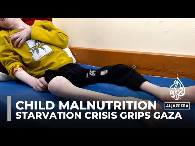 Vulnerable children in northern Gaza face heightened starvation risk