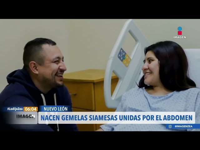 Nacen gemelas siamesas unidas por el abdomen en Nuevo León | Noticias con Francisco Zea