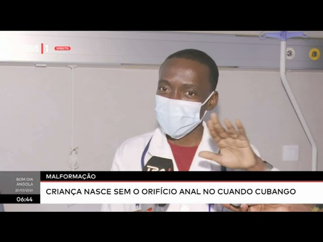 Criança nasce sem orifício anal no Cuando Cubango