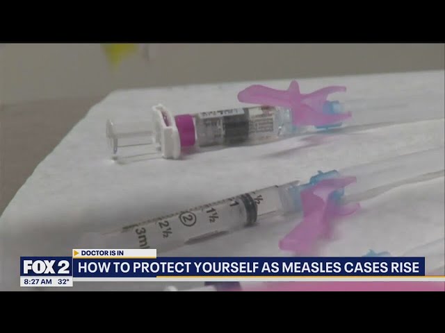 The Doctor Is In: What you need to know about the rise in measles cases