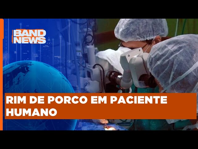 Médico brasileiro lidera transplante inédito no mundo | BandNews TV