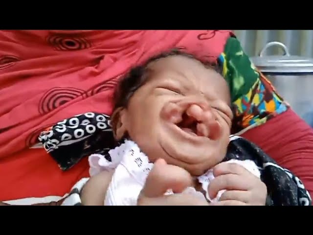 ⁣URGENT : Un nouveau-né malade à besoin d'une évaluation en urgence à l'étranger : MWANA TS
