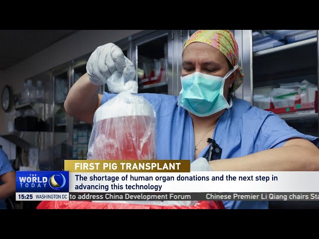 Pig kidney gets transplanted into human | Jayme Locke weighs in