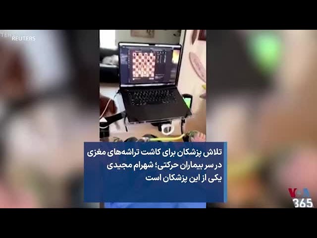 ⁣تلاش پزشکان برای کاشت تراشه‌های مغزی در سر بیماران حرکتی؛ شهرام مجیدی  یکی از این پزشکان است