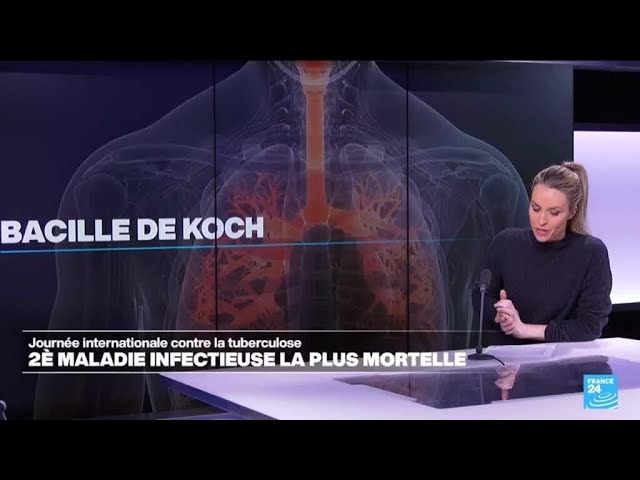 La tuberculose, deuxième maladie infectieuse la plus meurtrière au monde • FRANCE 24