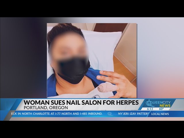 Woman sues nail salon after testing positive for Herpes