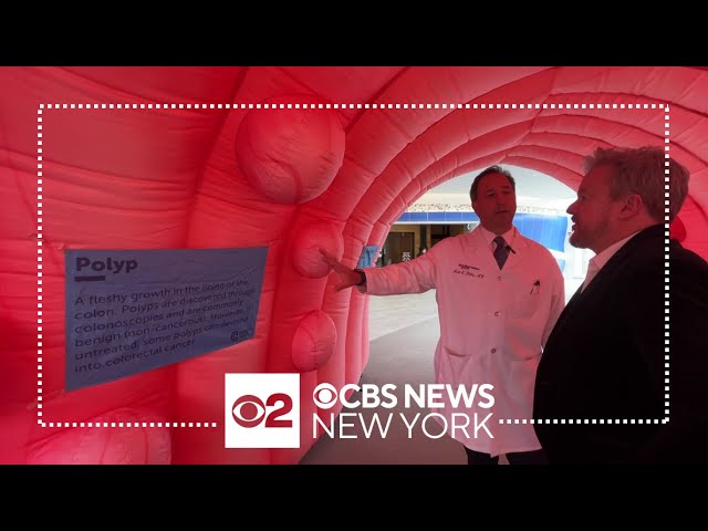Doctor shares what to know about Colorectal Cancer Awareness Month
