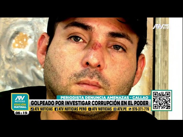 Callao: Periodista es golpeado y amenazado por investigar corrupción en el poder