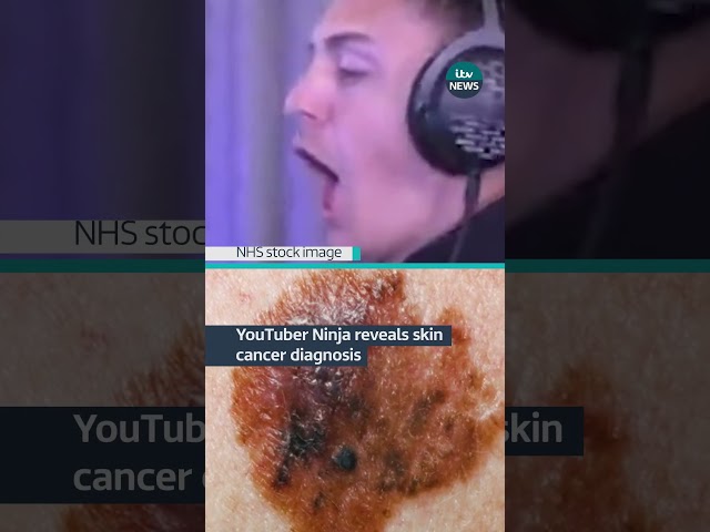 YouTuber reveals skin cancer diagnosis #itvnews #news