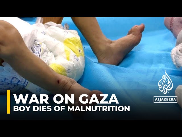 War on Gaza: Boy dies of malnutrition, doctors sound alarm