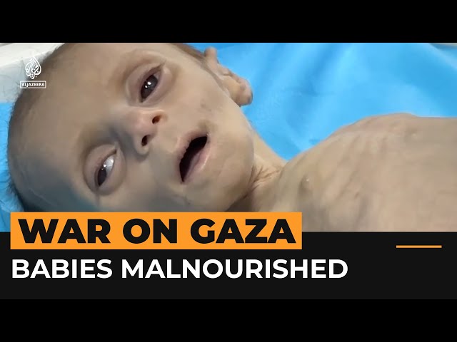 Babies are dying of hunger and dehydration in Gaza | Al Jazeera Newsfeed