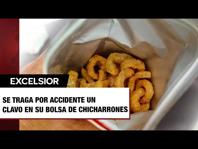 Mujer se traga por accidente un clavo en su bolsa de chicharrones; la operan de urgencia