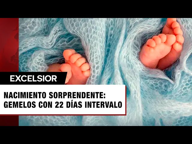 Mamá queda en shock tras dar a luz a gemelos con 22 días de diferencia