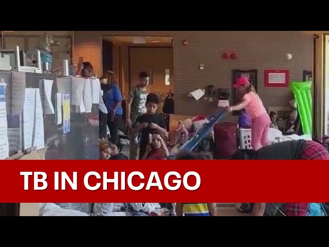 Tuberculosis cases reported at a few migrant shelters