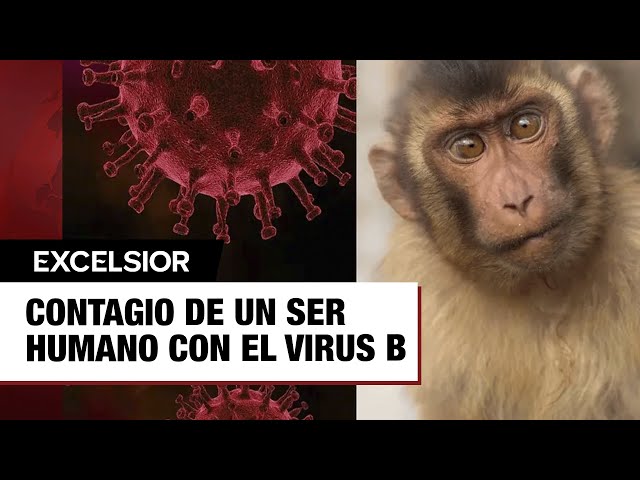 ⁣¿Qué es el virus B? Síntomas de enfermedad peligrosa contagiada por monos