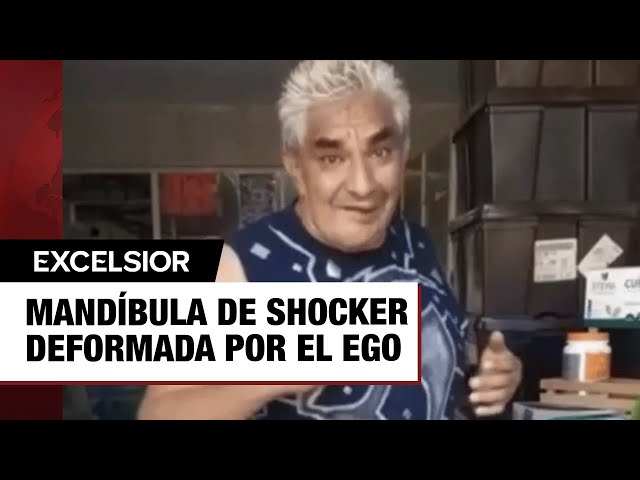 ¿Qué le pasó a Shocker en la cara? Así fue su accidente en la mandíbula