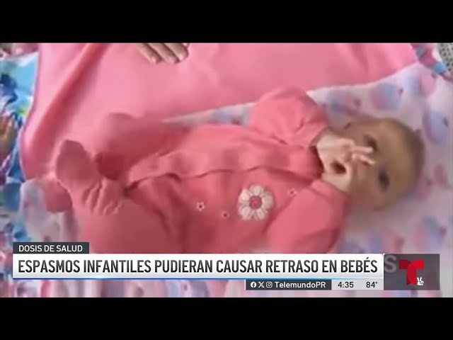 Espasmos infantiles: pequeñas convulsiones en bebés